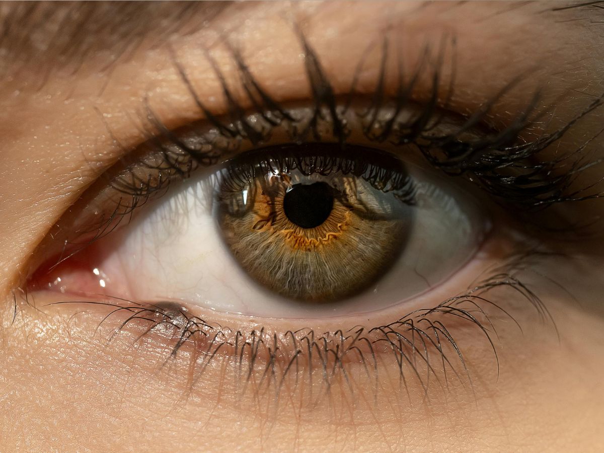 orange peel myth - Photo Gallery