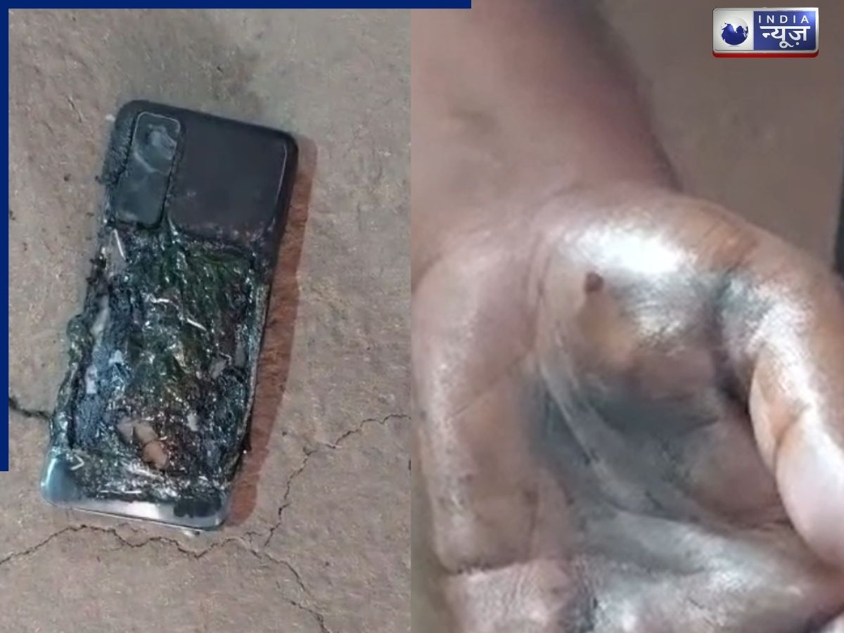 Chhattisgarh Mobile Blast: पैंट की जेब में मोबाइल रखने वाले सावधान! युवक के जींस में हुआ विस्फोट, जांघ और हाथ जला