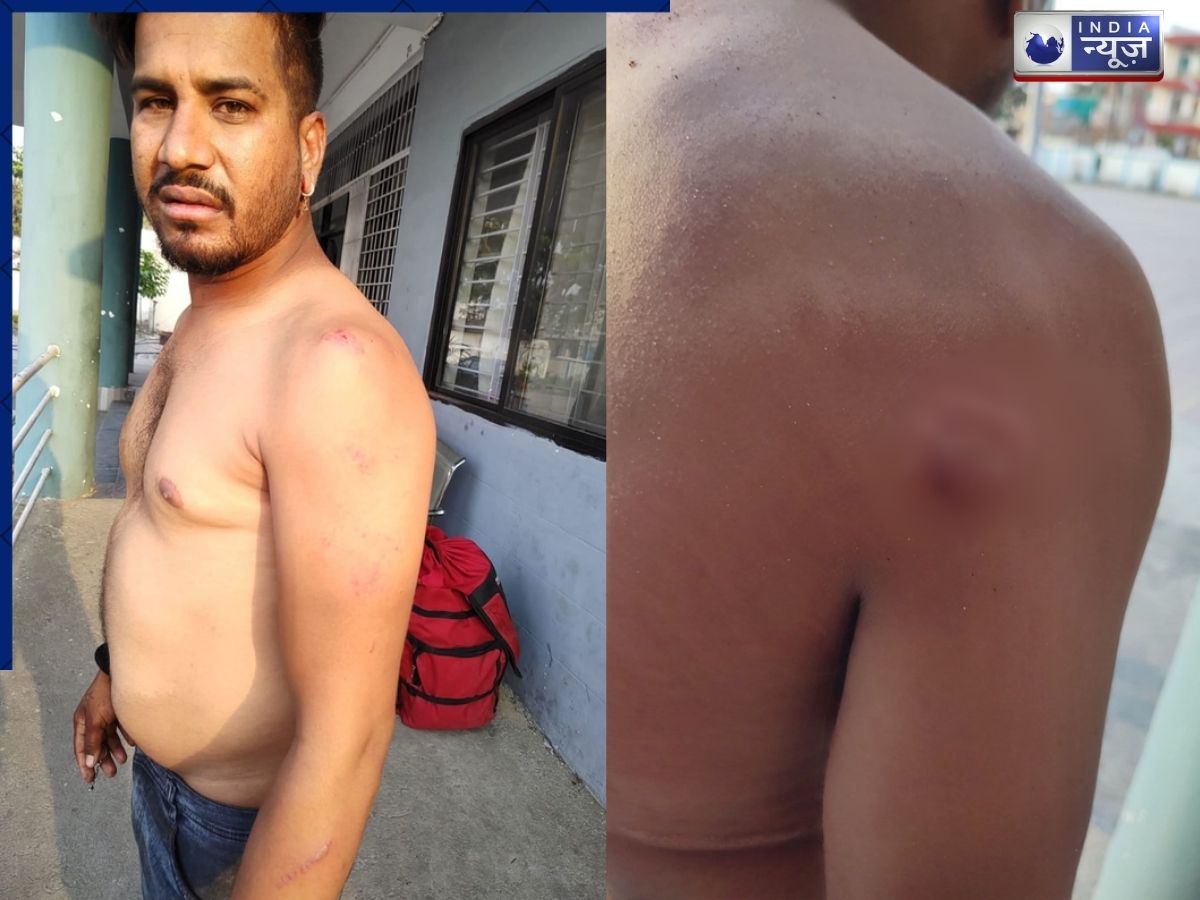 Singrauli News: सिंगरौली में पार्सल बना विवाद की जड़, डिलीवरी बॉय से मारपीट, FIR दर्ज