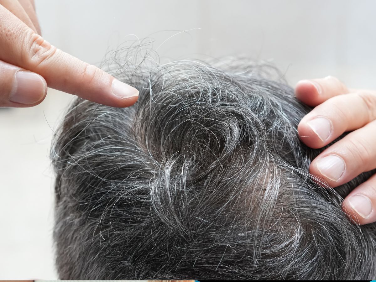 White hair problem - Photo Gallery