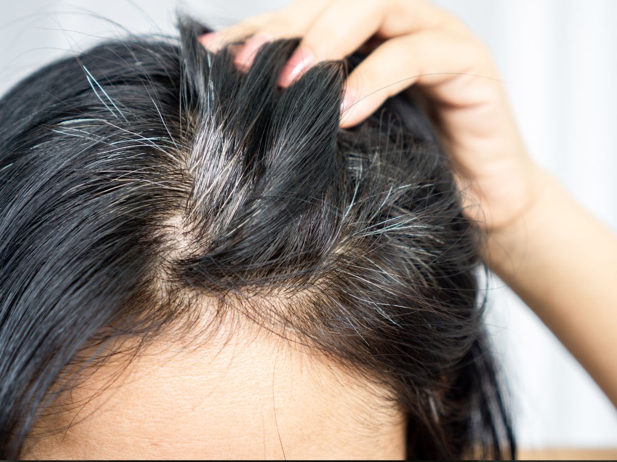 White hair problem - Photo Gallery