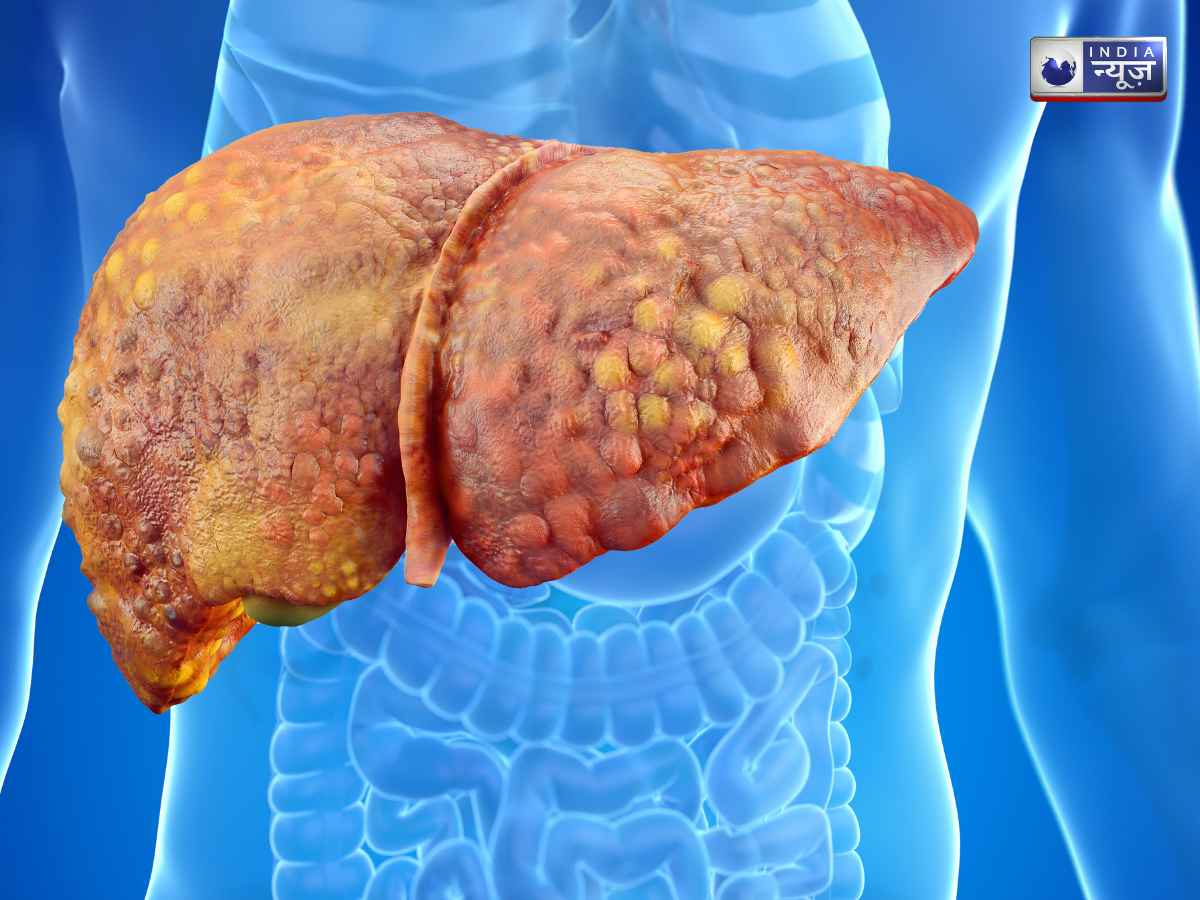 Liver Damage: कितना परसेंट डैमेज हो चुका है आपका लिवर? स्किन पर दिख रहे हैं ये 4 बदलाव; भूलकर भी न करें नजरअंदाज