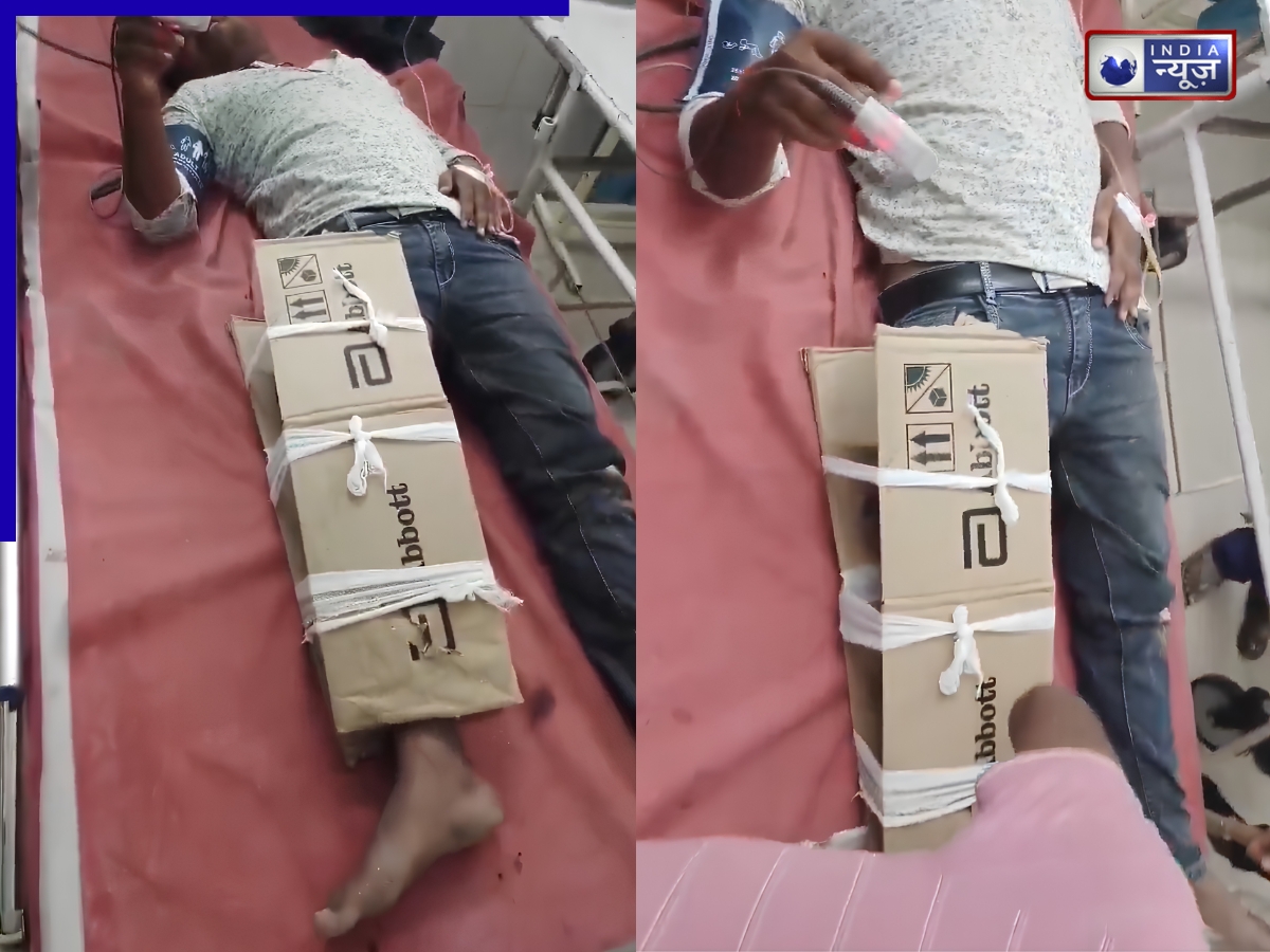 टूटा पैर लेकर अस्पताल पहुंचा मरीज, प्लास्टर नहीं था तो डॉक्टरों ने बांध दिया गत्ता, देखें वीडियो