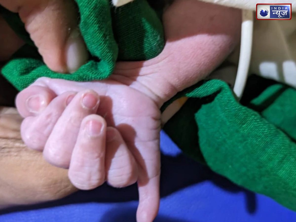 Birth with extra fingers: 24 उंगलियों के साथ जन्म, क्यों होती है ऐसी स्थिति? क्या है इलाज और वजह