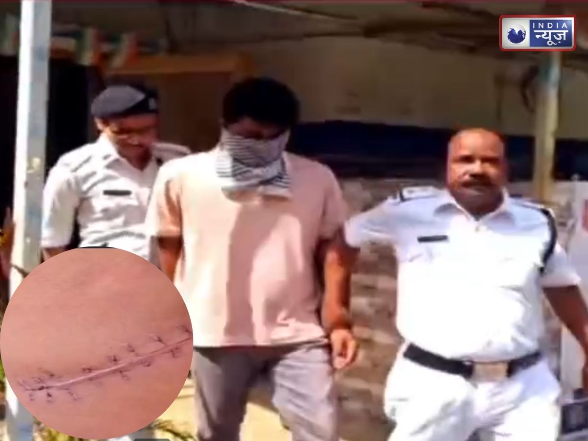 नौकरी का झांसा देकर निकाल लेता था किडनी: बांग्लादेशी मास्टरमाइंड गिरफ्तार, ऐसे बिछाता था जाल; देखें Video