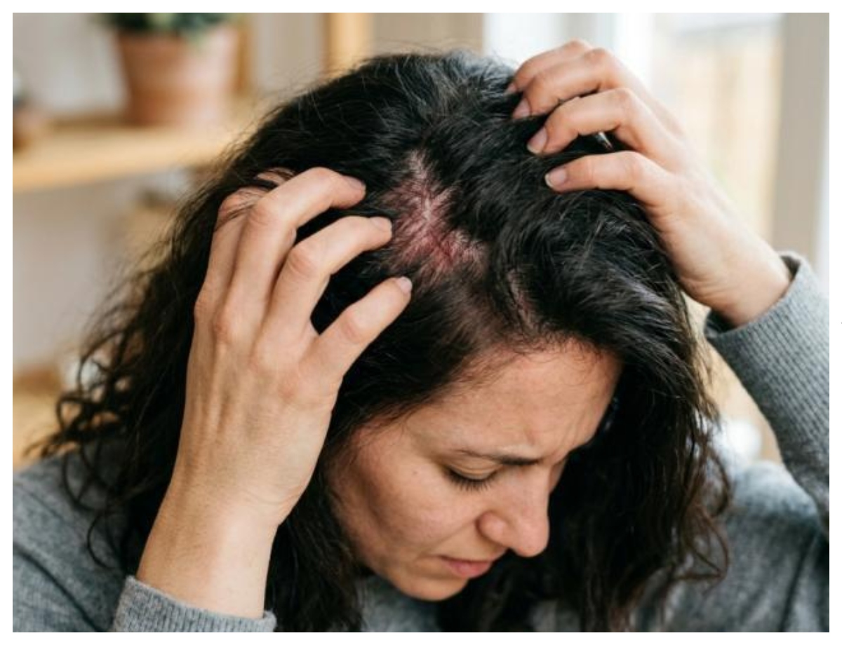 Aloe vera may not be right for every scalp - Photo Gallery