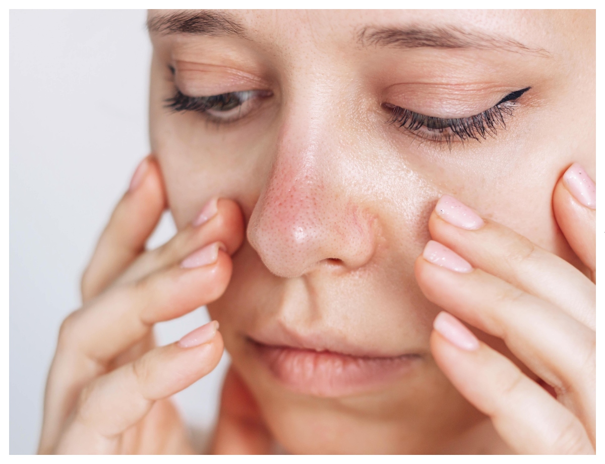 Seborrheic dermatitis can also be the cause - Photo Gallery