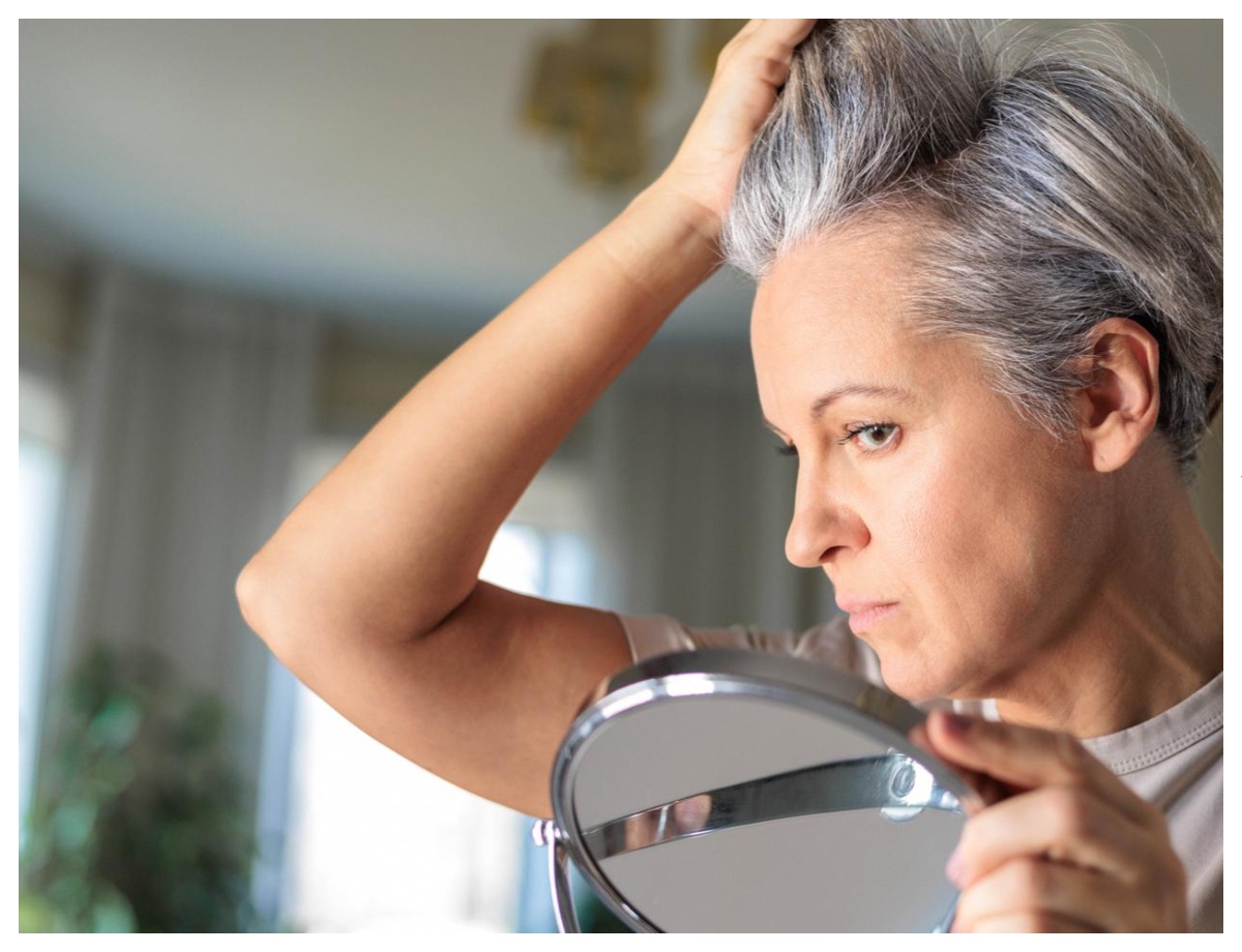 Why are hair turning white at a young age? - Photo Gallery