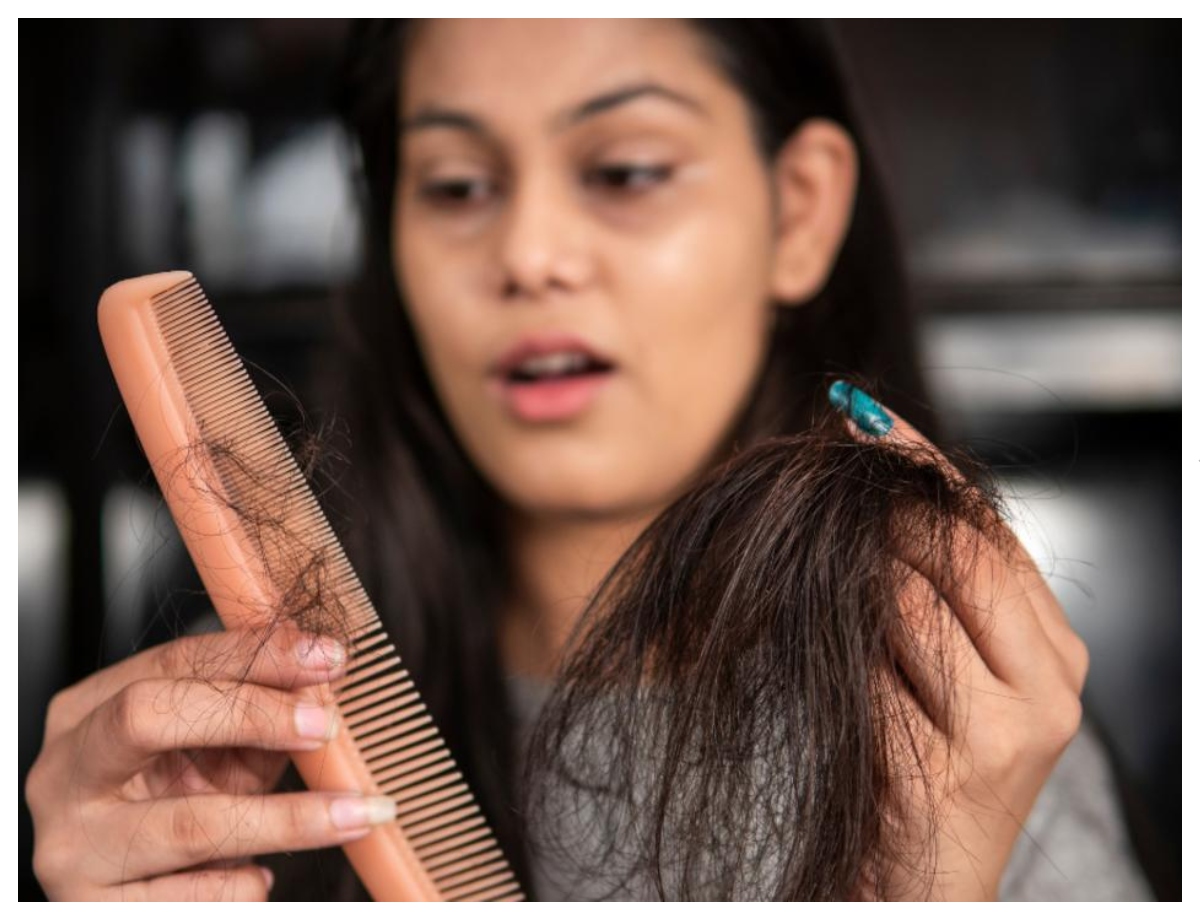 Hair falling out along with white hair? - Photo Gallery