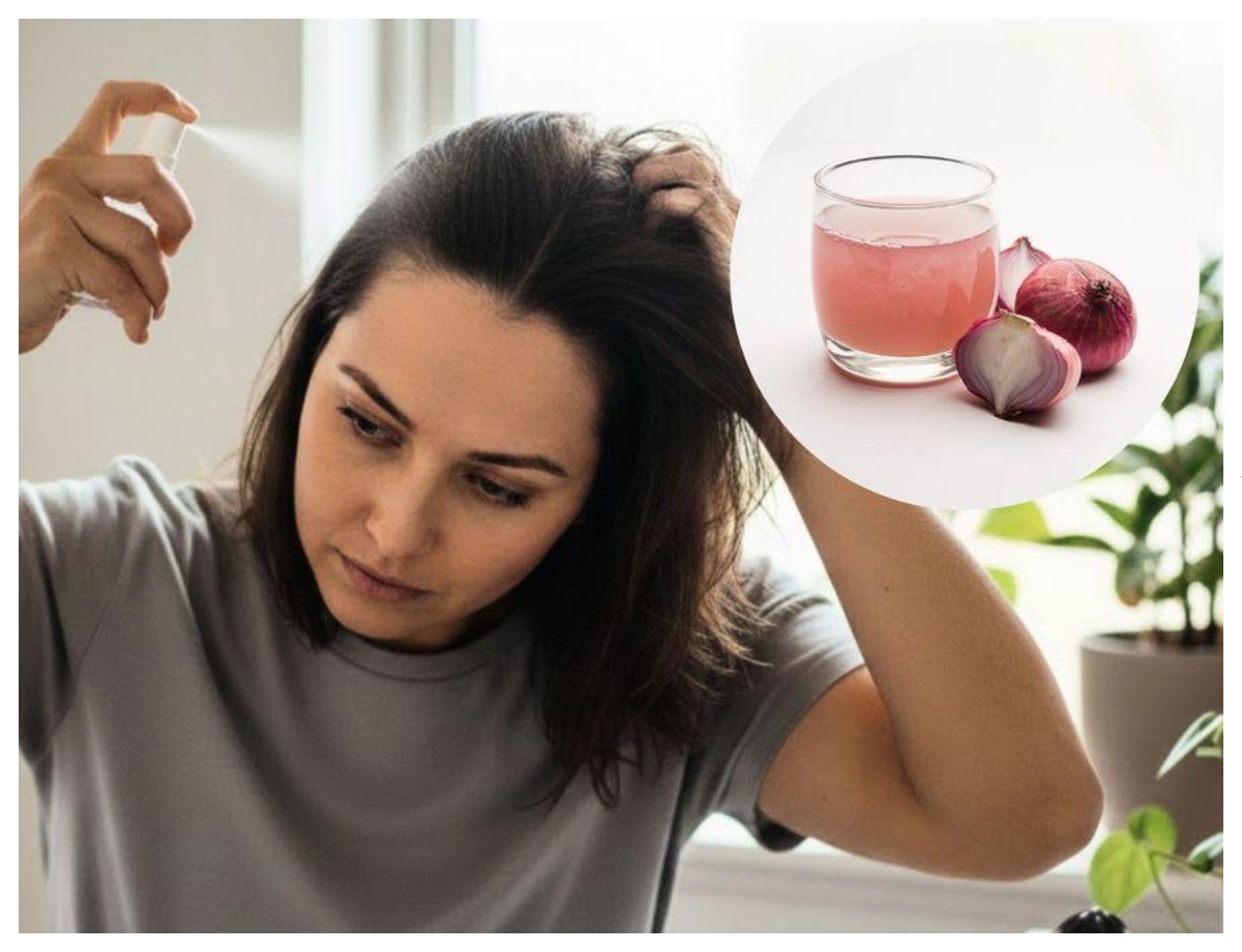 Onion juice is used in hair care - Photo Gallery